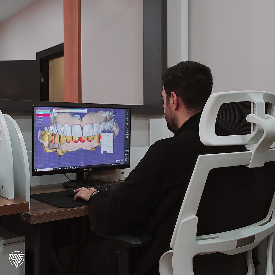 Technician working on a smile design at the screen