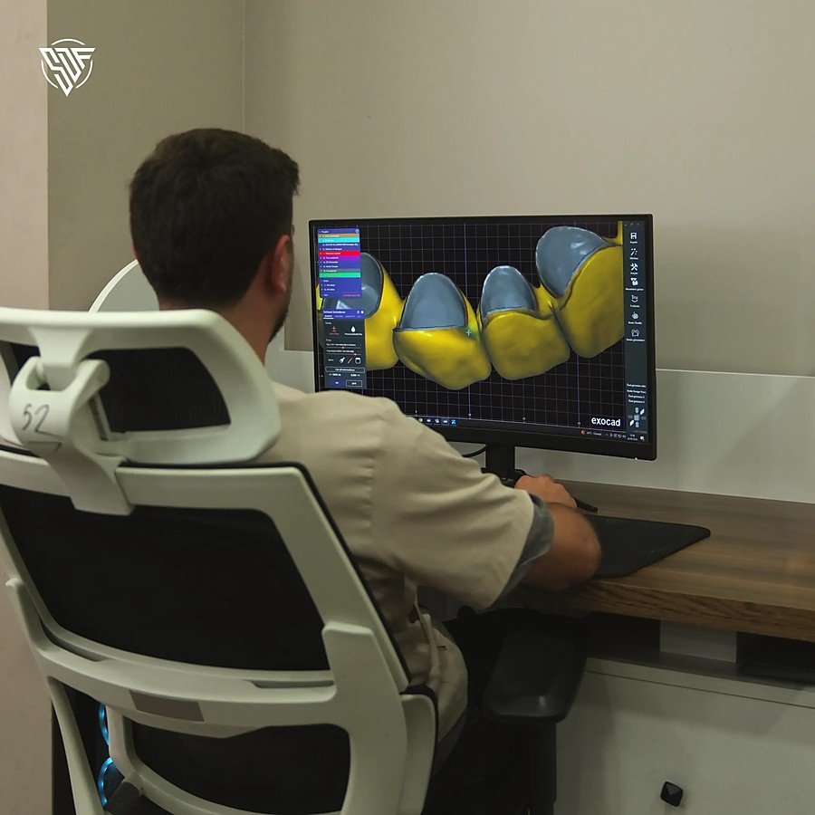 Technician modelling crowns in CAD software