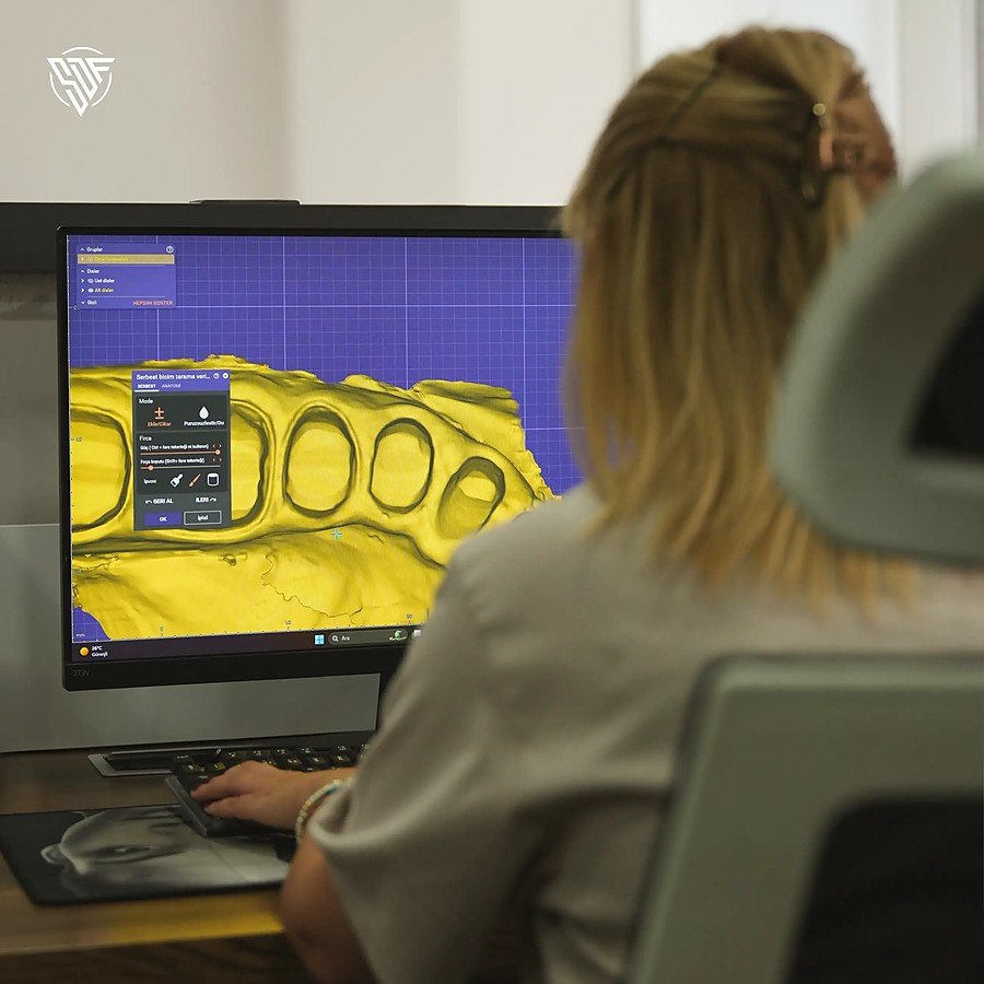 Scanned jaw shown in the design software